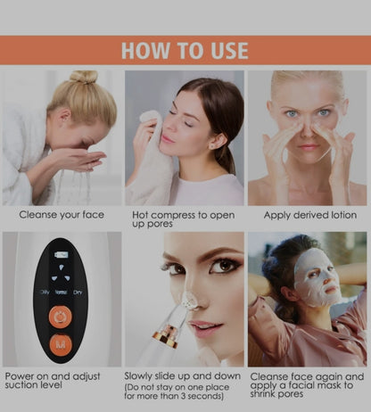 Blackhead remover