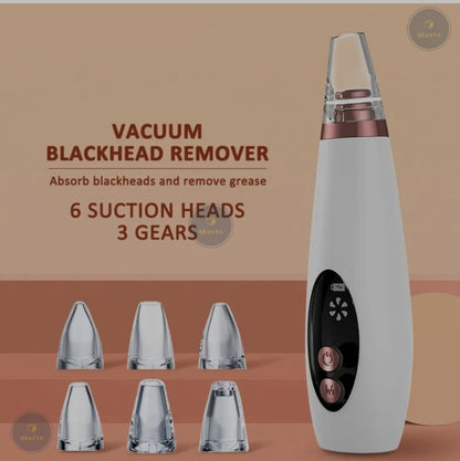 Blackhead remover